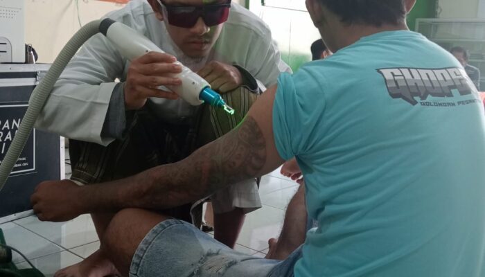 Program Hapus Tato Gratis ke-2 Masjid Lautze 3 di Pekalipan